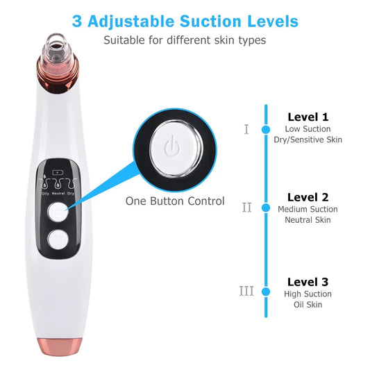 SmartSkin WiFi Blackhead Vacuum