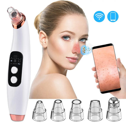 SmartSkin WiFi Blackhead Vacuum
