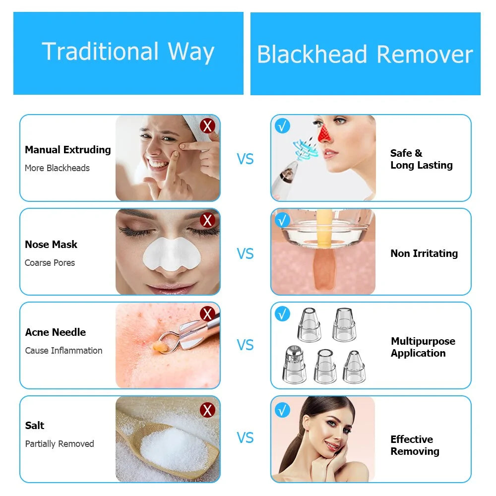 SmartSkin WiFi Blackhead Vacuum