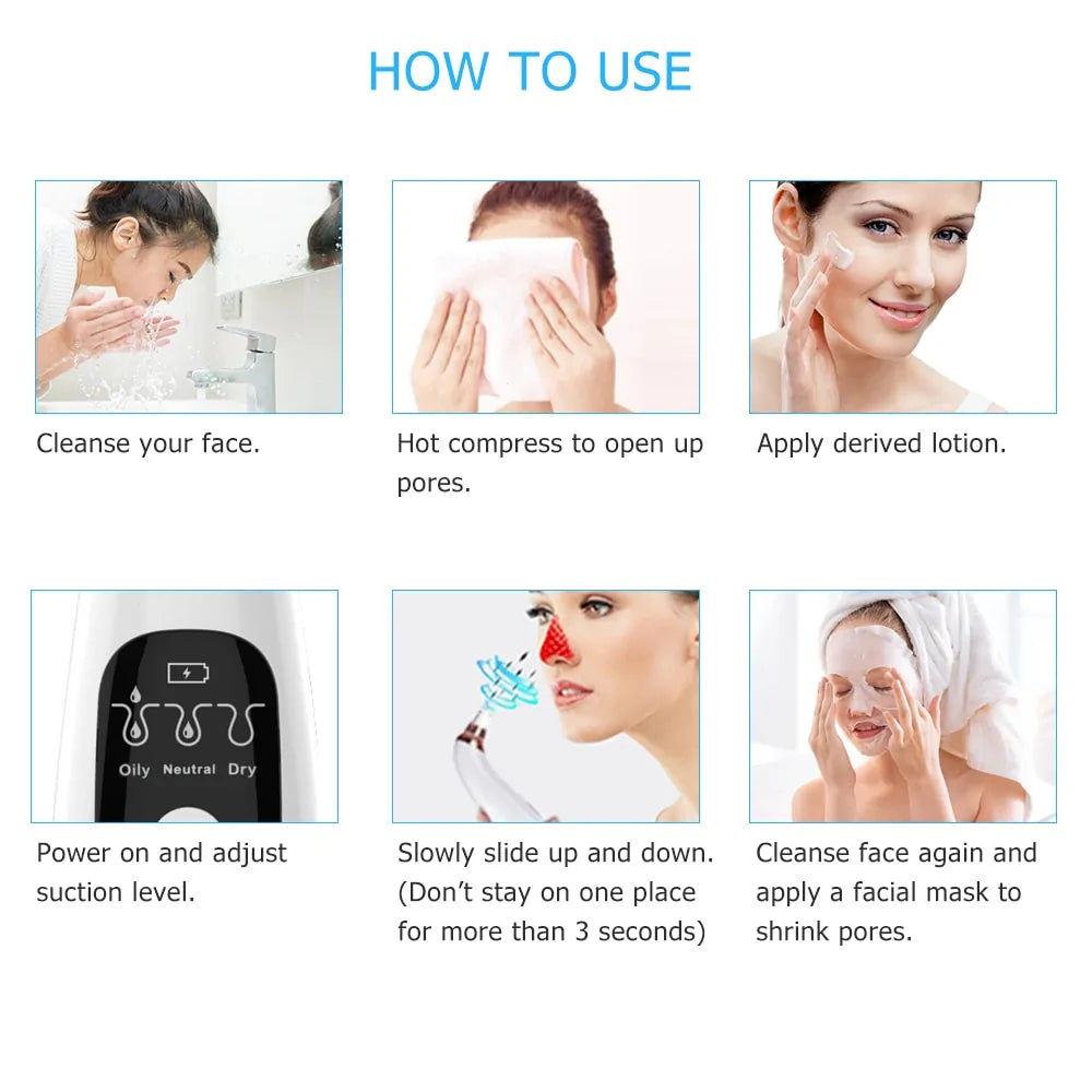 SmartSkin WiFi Blackhead Vacuum