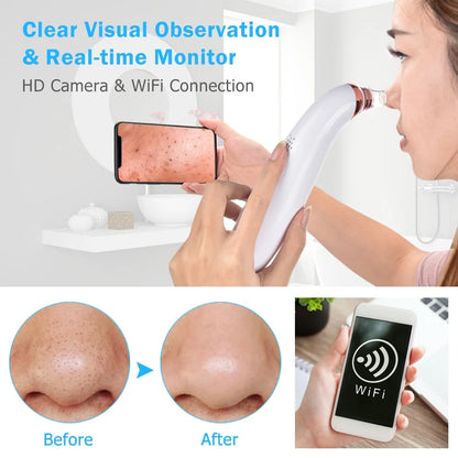 SmartSkin WiFi Blackhead Vacuum